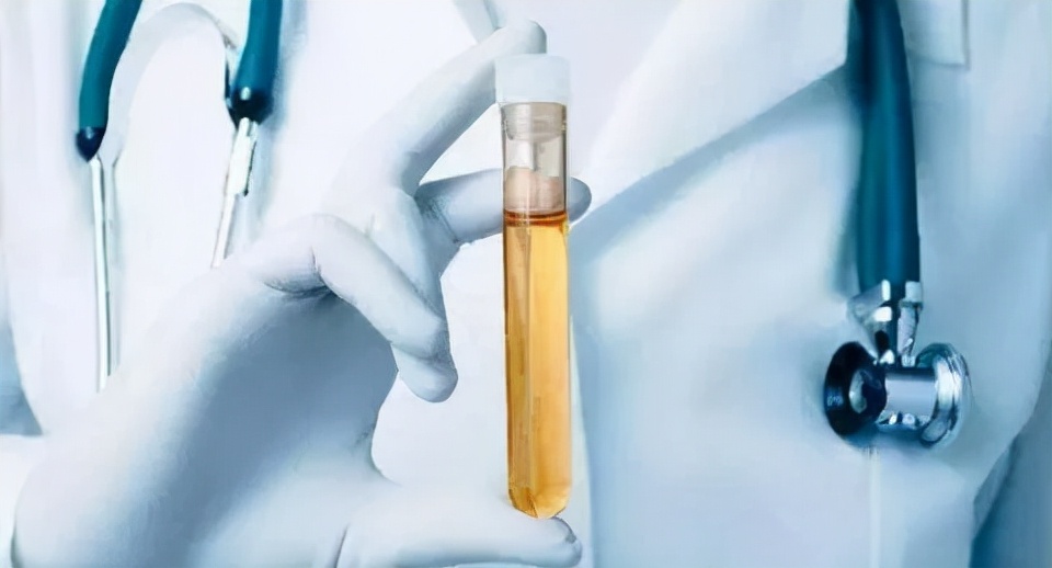 总是口干舌燥（早起口干舌燥怎么回事）