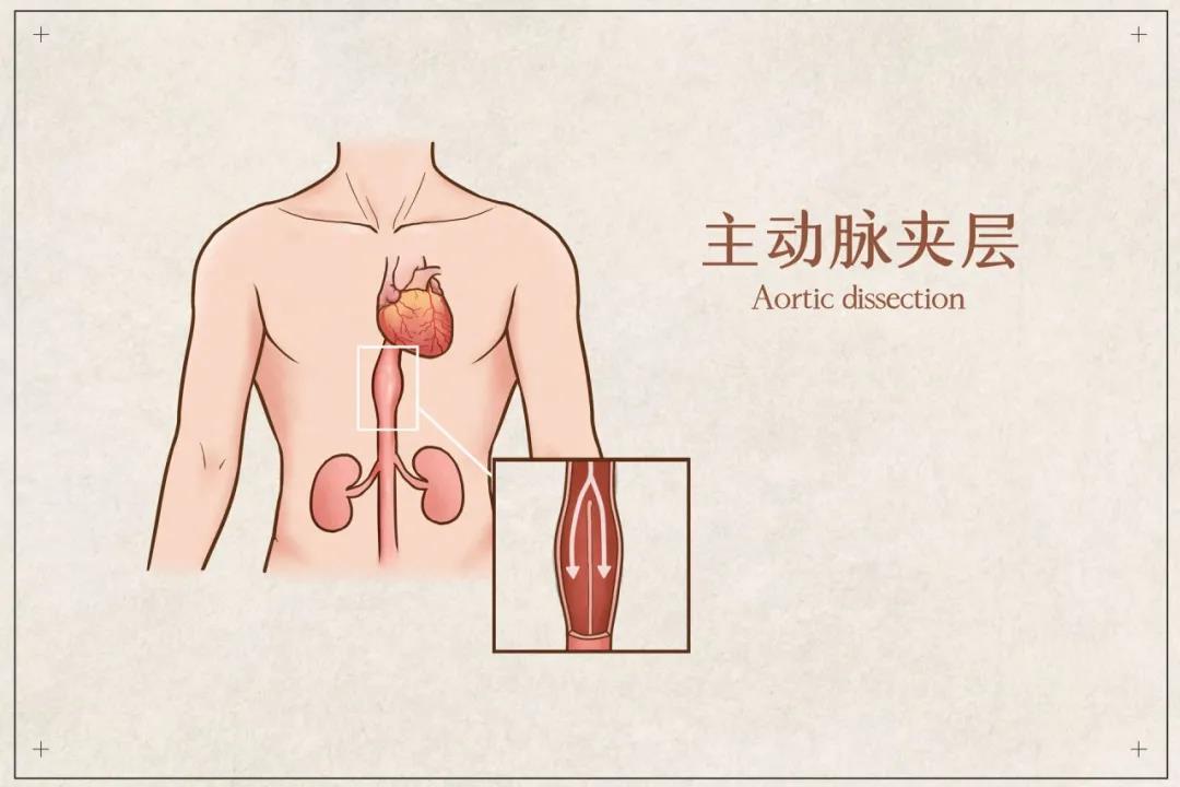 这些疾病的疼痛程度不亚于古代的酷刑，看完你还敢得病吗