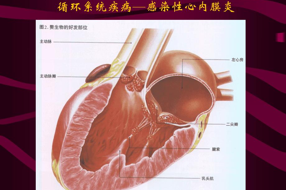 真实故事：32岁小伙拉肚子导致心脏骤停，医生拼尽全力也无力回天