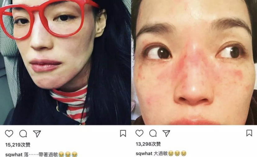 吴磊碰枸杞会手肿，贾玲不吃饭会长红斑，是矫情还是真“有病”？