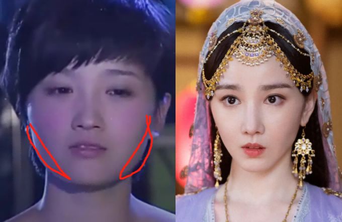 瘦到病态，动脸成瘾，切胃、剪肠齐上阵，内娱的畸形审美真可怕