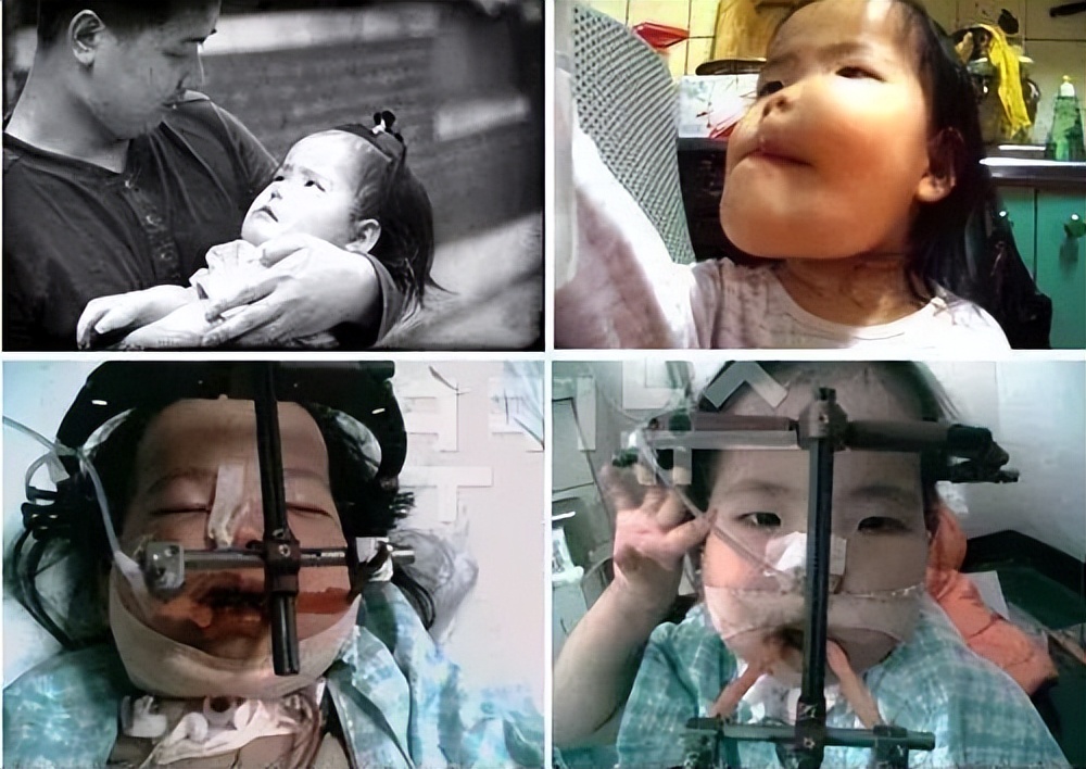 韩国好爸爸虐待少女，残疾女儿竟是帮凶，妻子也曾遭受侵害