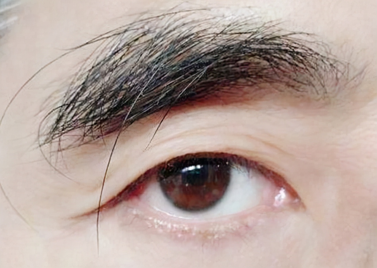 头发最长的人图片(九旬老人眉毛突然疯长) - 赤虎壹号