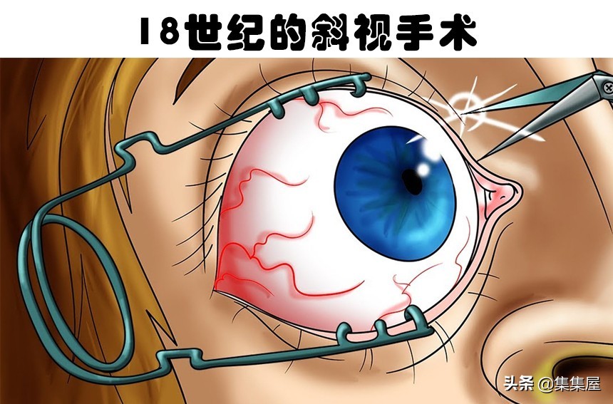 眼睛受到灼伤有多痛？人类所能经历的5件最严重的痛苦