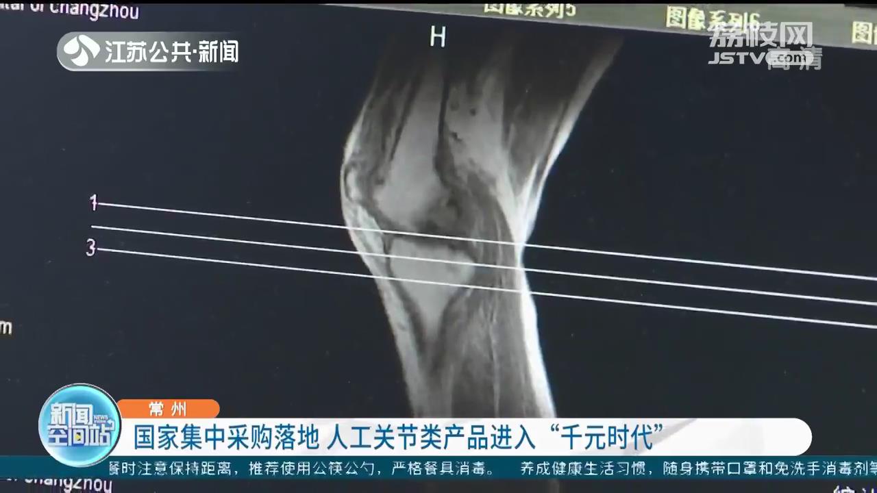 国家集中采购落地江苏 人工关节类产品进入&ldquo;千元时代&rdquo;
