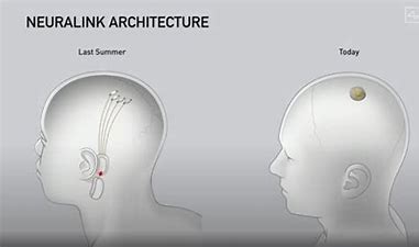 马斯克上传大脑？世界发展的比我们想象的快