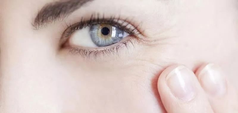 如何消除眼纹？记住这5个实用方法