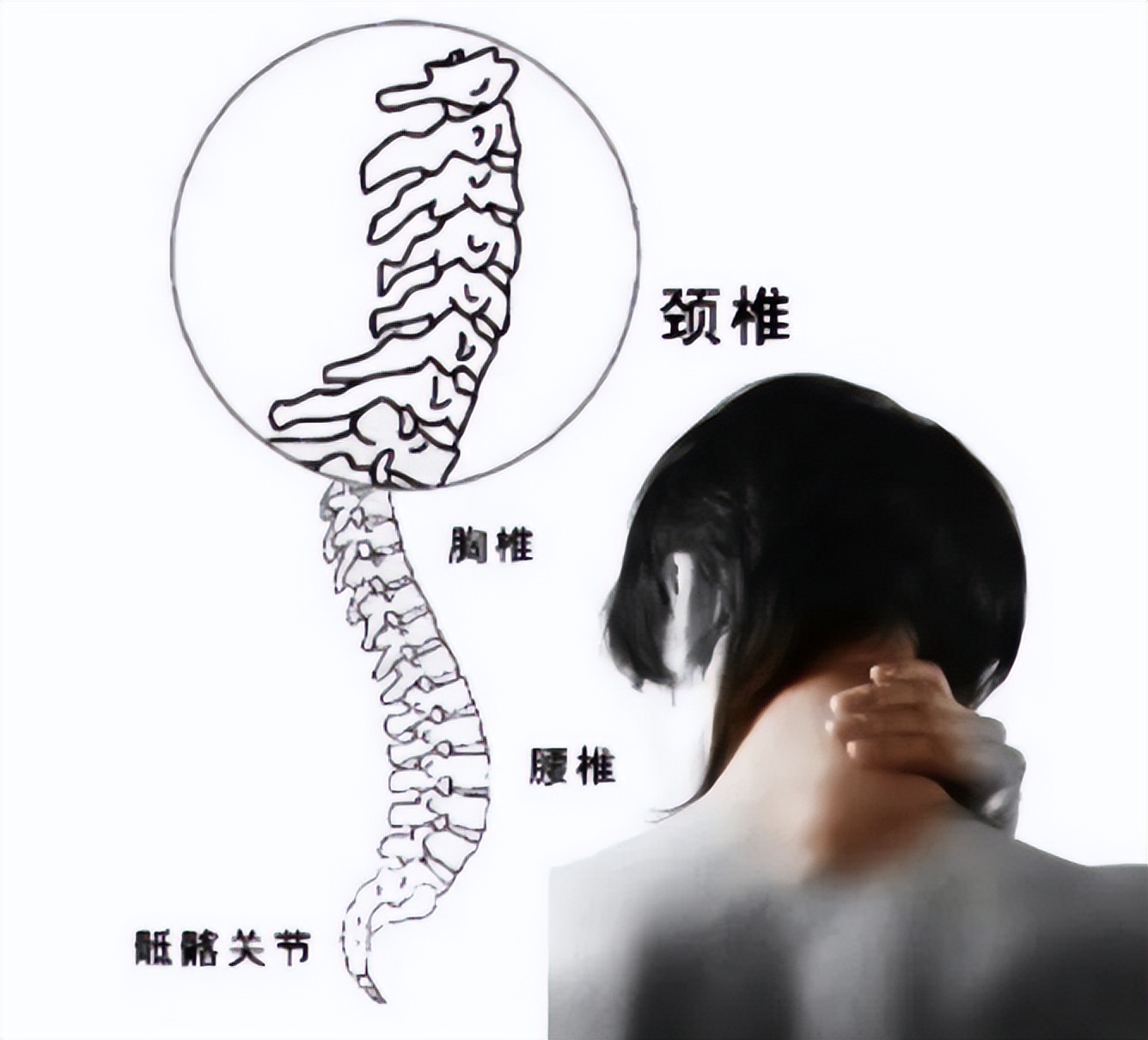 颈椎病是“早期”还是“晚期”？出现这些情况，一定要上医院
