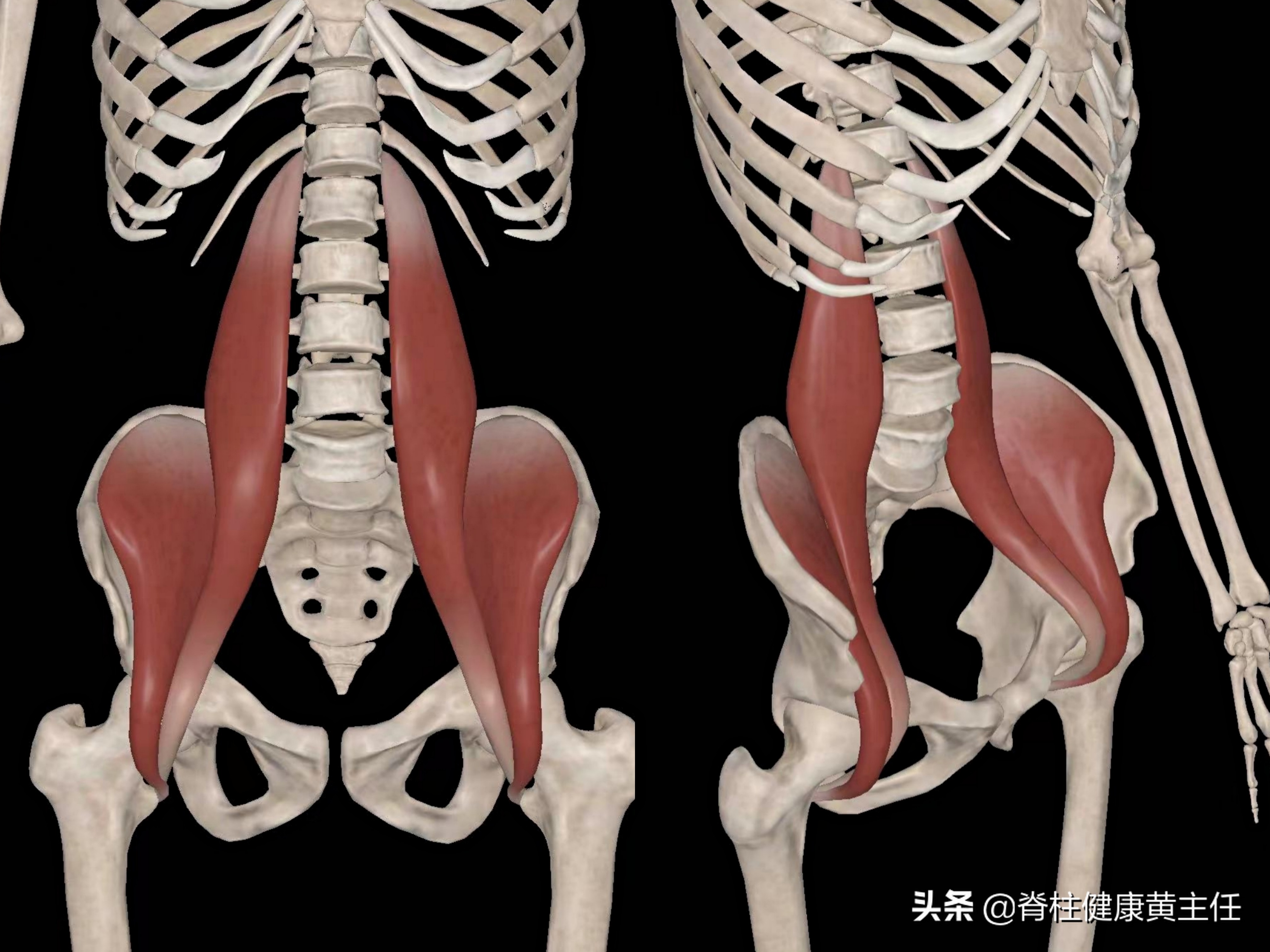 腰部疼痛位置圖片大全(腰痛不是椎間盤突出) - 赤虎壹號