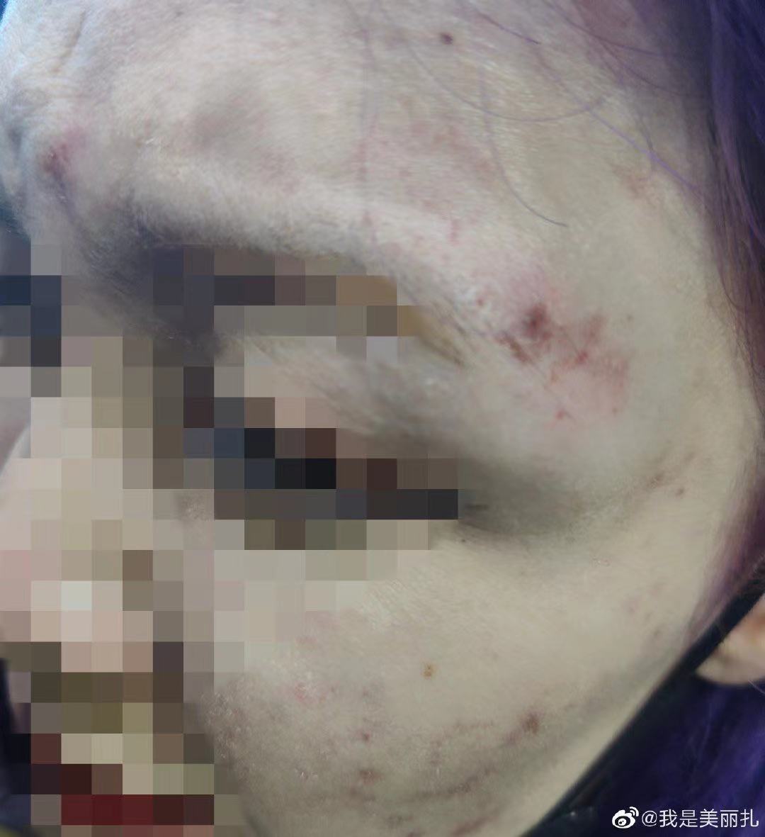 成源打人后續（酒后毆打女孩球員被拘留10日罰款500元 家屬：將根據傷情鑒定結果提出復議）