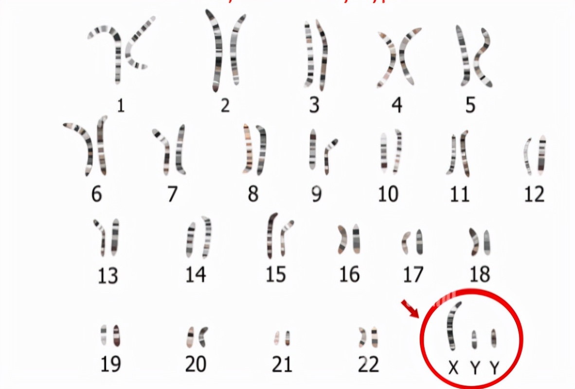 男人的染色体是xy,女人是xx,染色体是"yy"会是什么样子呢?
