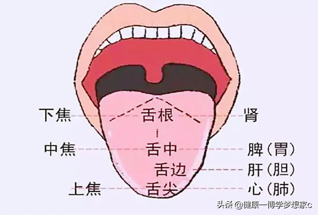 早起照鏡子，你的舌頭邊上有沒有齒痕，齒痕舌代表什麼意思