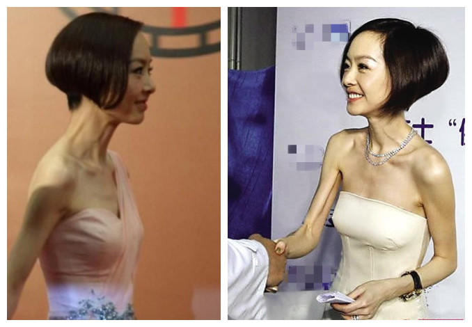 胖了上镜不好看？可头大身小排骨胸，女明星们瘦得这么病态也惊悚