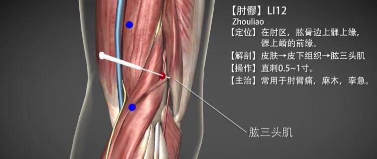 怎样治疗网球肘炎(肘髎穴—治疗网球肘（肱骨外上髁炎）)