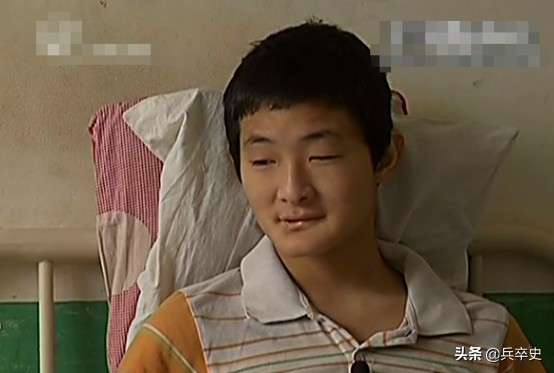 真实故事：山东17岁男孩无痛感汗腺，自我伤害博痛觉，父母泪崩