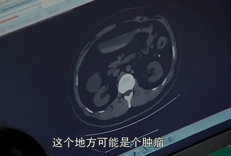 27岁男子三天没有排气排便，腹痛到无法走路，检查结果让妻子绝望
