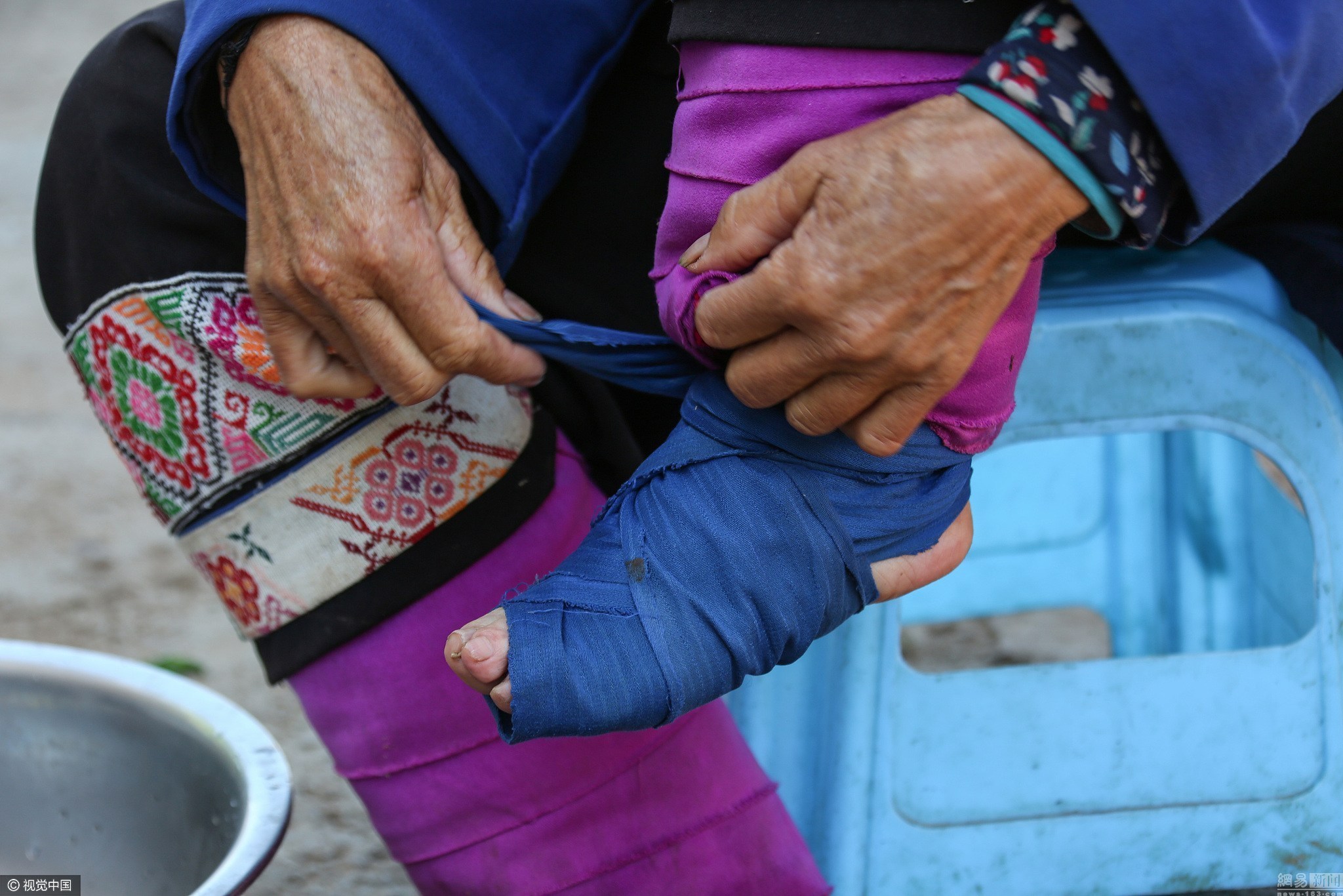 除了布裹之外,部分地区还有用竹片,石板的,有的还会在脚底绑上锋利的