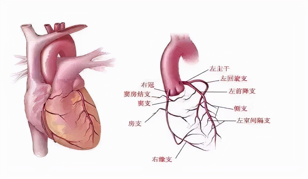 心脏冠脉造影图解图片
