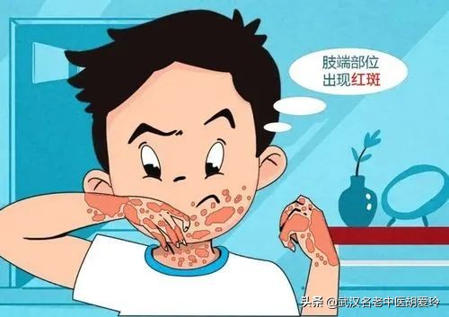 皮膚最近脫皮紅腫特別癢怎麼回事