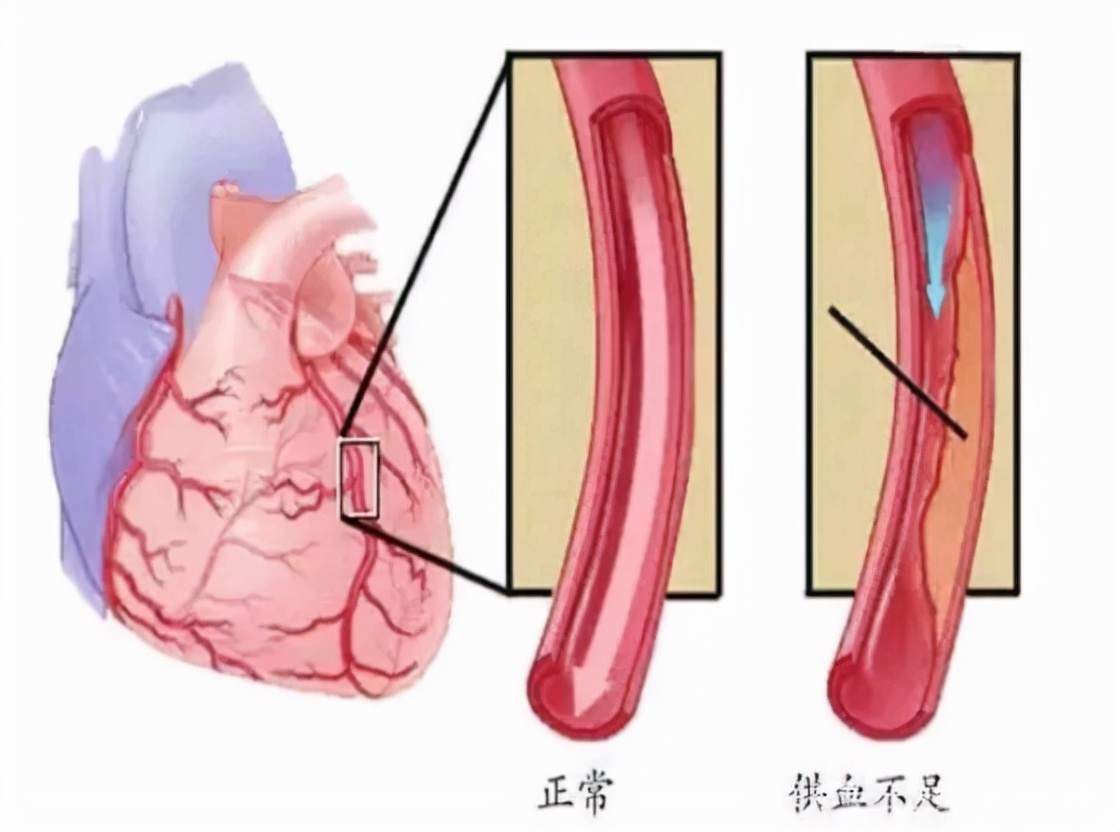 倍他乐克最适合3类人群，但有7类人要禁用，早知道早受益