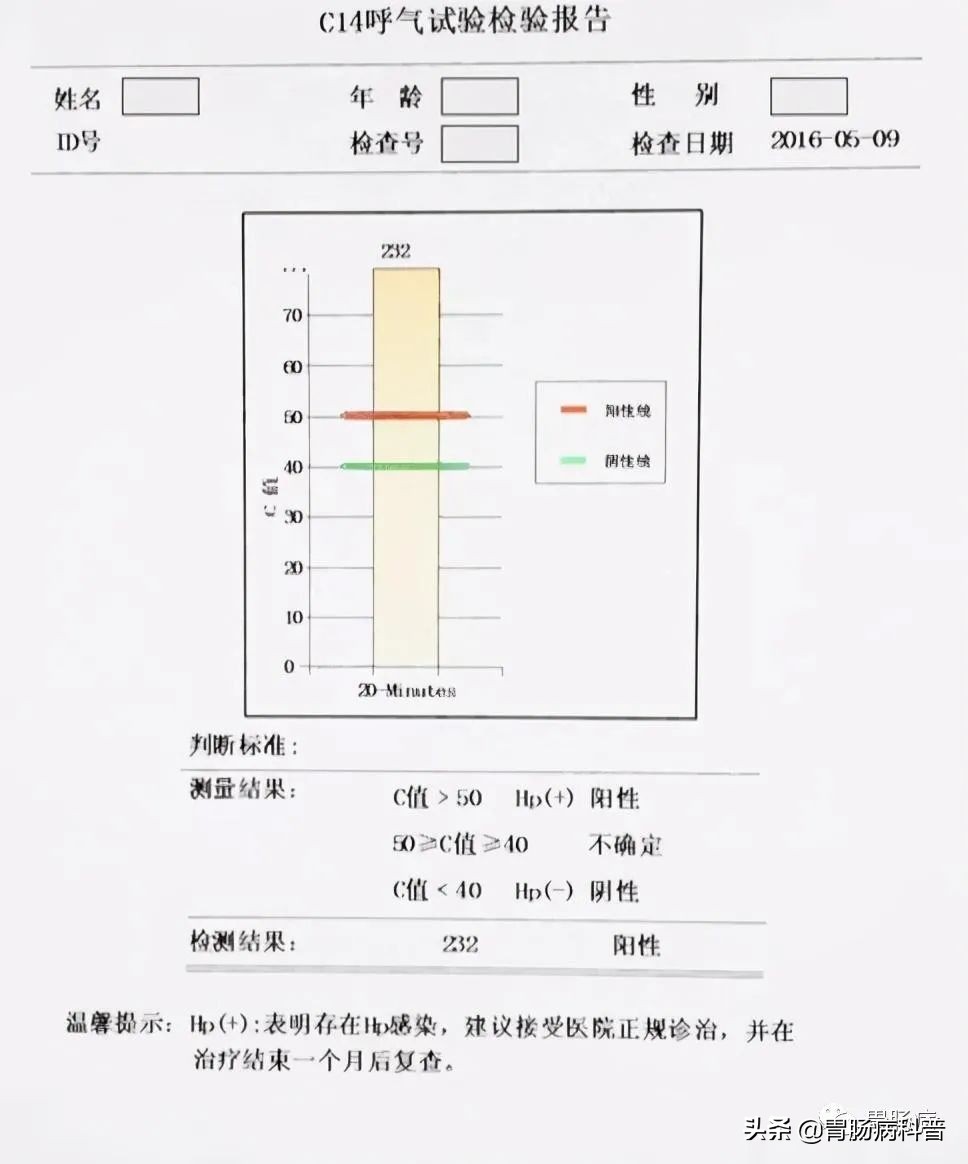 做碳14呼气试验多少钱幽门螺杆菌呼气试验