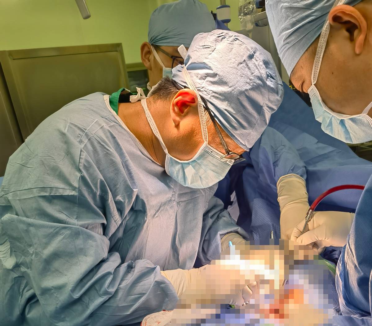 胸椎侧后凸畸形VCR截骨矫形手术帮助35岁小伙挺起脊梁
