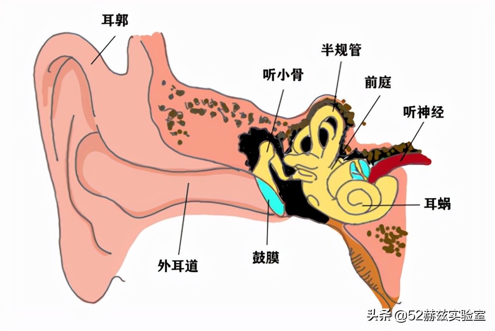 进口人工耳蜗要30万？国产货硬气说不，打破国外垄断