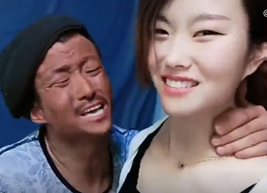 蛤蟆等天鹅搞笑图片(蛤蟆哥) - 赤虎壹号