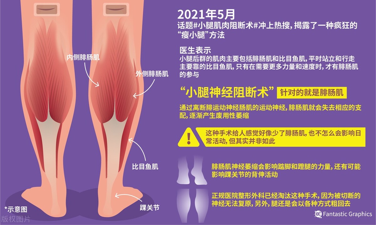 颅顶增高、小腿肌肉阻断、断骨增高，“酷刑”医美缘何前赴后继？