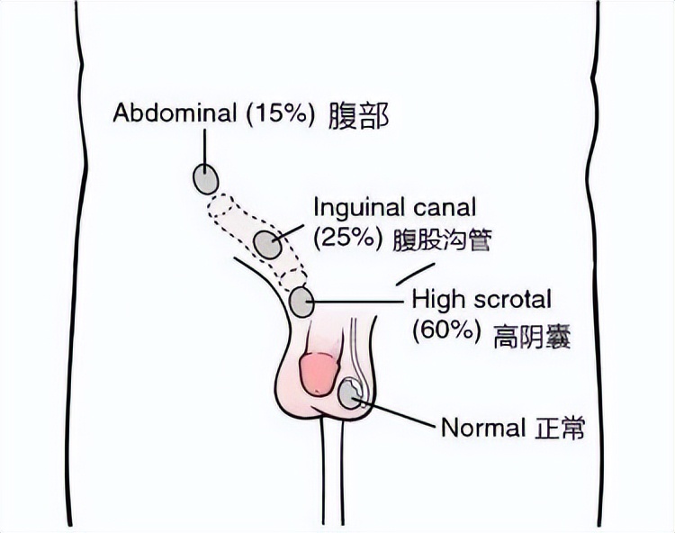 蛋碎了能死吗(热水烫蛋能避孕吗？多热有效？)