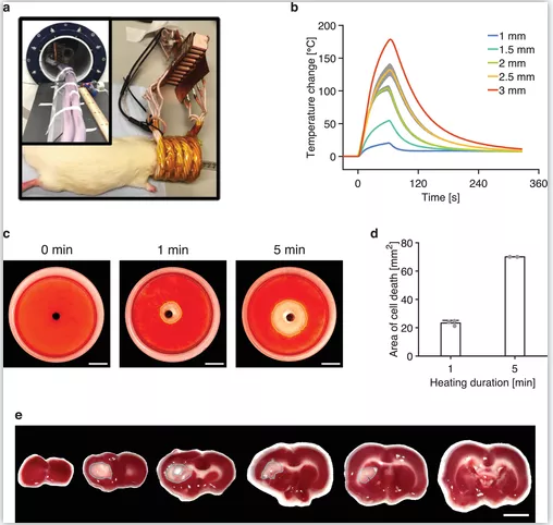 颠覆性科技！MRI“微型切割刀”除肿瘤