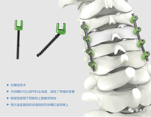 国内上市公司盘点：威高骨科