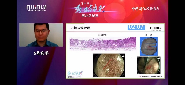入围总决赛 西安市红会医院消化内科获西北区域赛一等奖