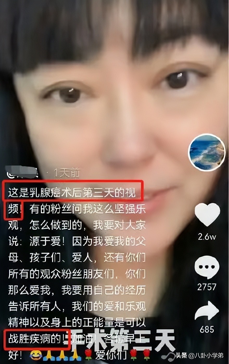 年轻时肤白貌美，如今只能演土气大妈，岁月这把“杀猪刀”太可怕