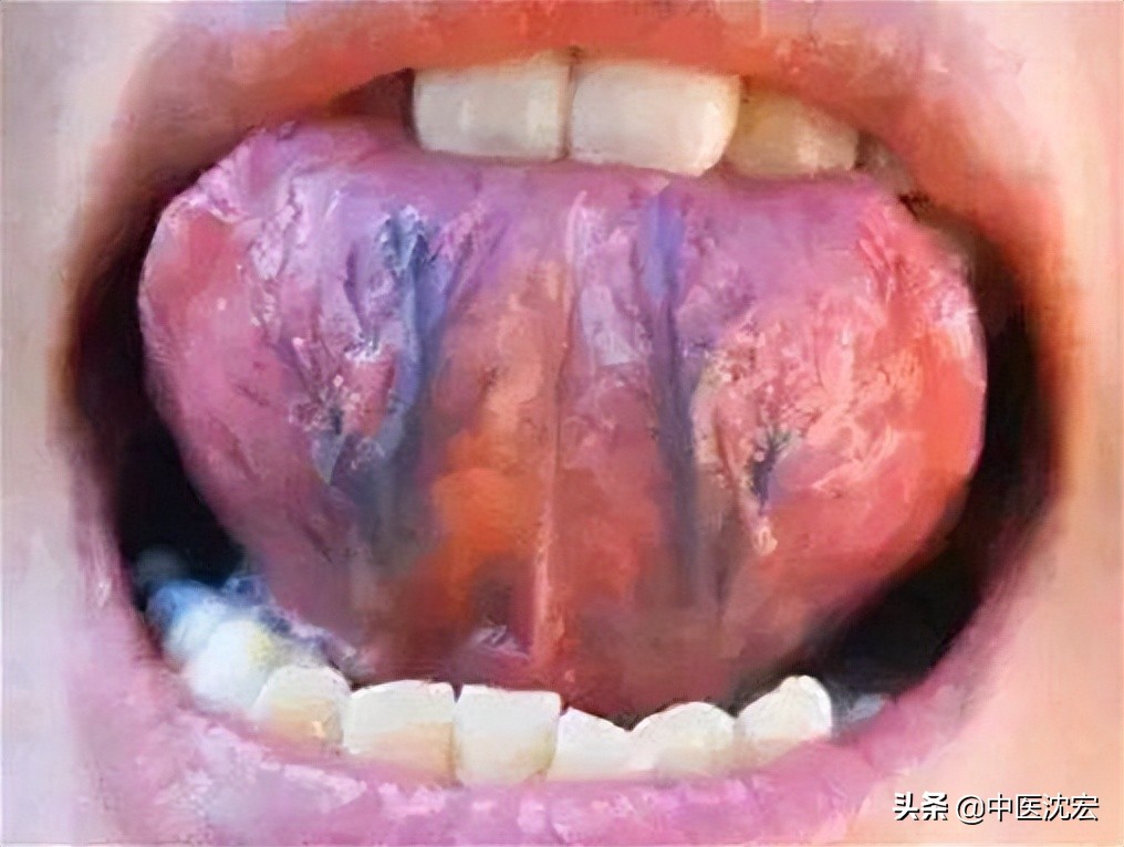 舌頭底下有兩條“大青筋”，代表身體出問題了？ 又該如何調理？