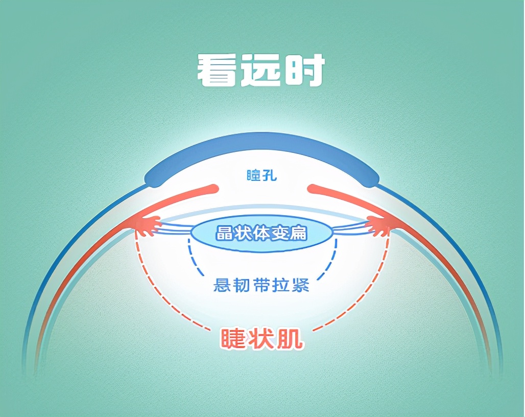 近距离用眼睫状肌会怎么(长时间近距离用眼睫状肌)-启扬谈近视