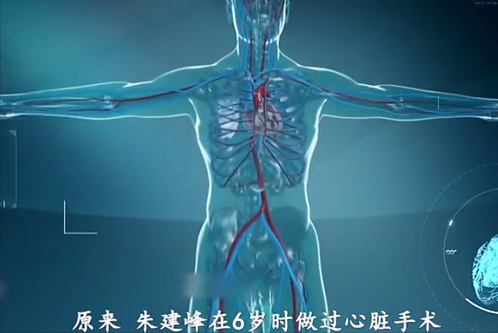 真实故事：32岁小伙拉肚子导致心脏骤停，医生拼尽全力也无力回天