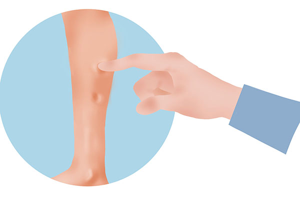 肾脏不好会有哪些异常？做到“吃二粥，喝二汤”，肾脏更健康