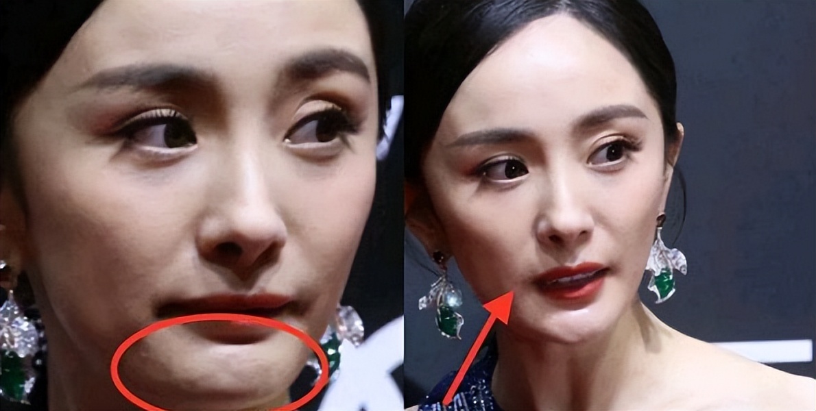 痘痘脸、赘肉、五五分！生图里的女星，让我看见了人间真实