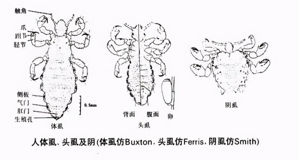 Bret(这是真的！与人类共存，活上千万年了，为何虱子现今很难见到了？)