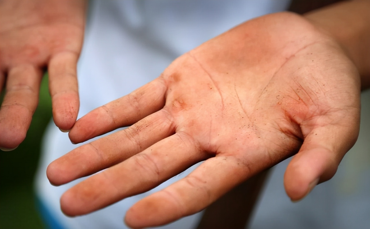 17岁农村女孩考上中山大学，为攒学费每天下地干活