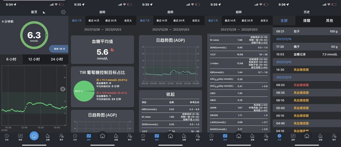 微泰动泰血糖仪体验｜让你不用扎手指，还能实时检测你的血糖值