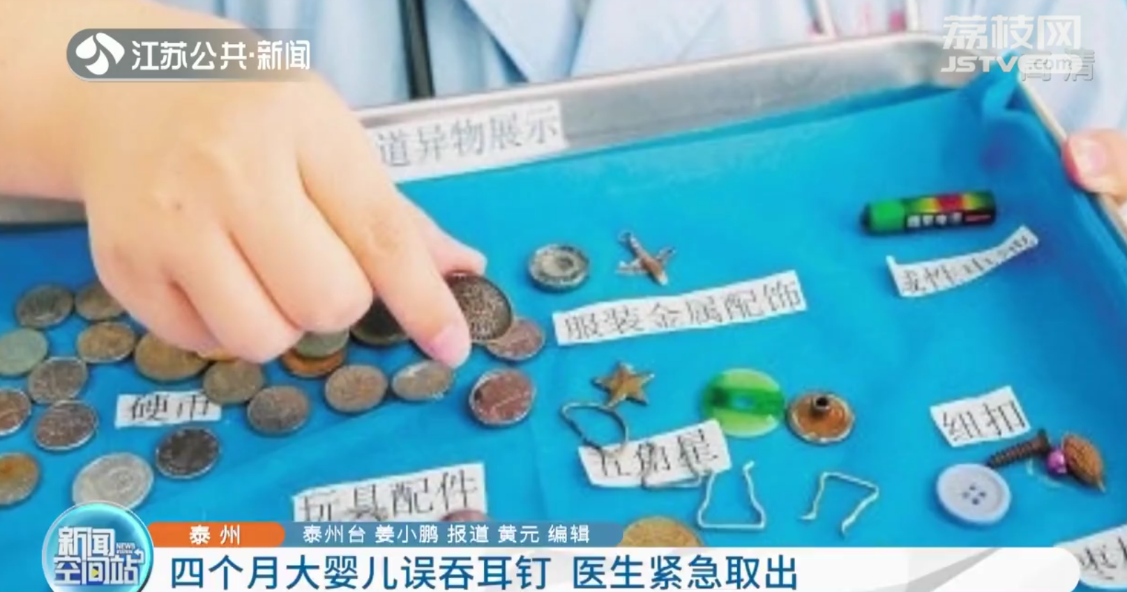 泰州4个月宝宝扯下奶奶耳坠吞下肚 医生胃镜手术取出