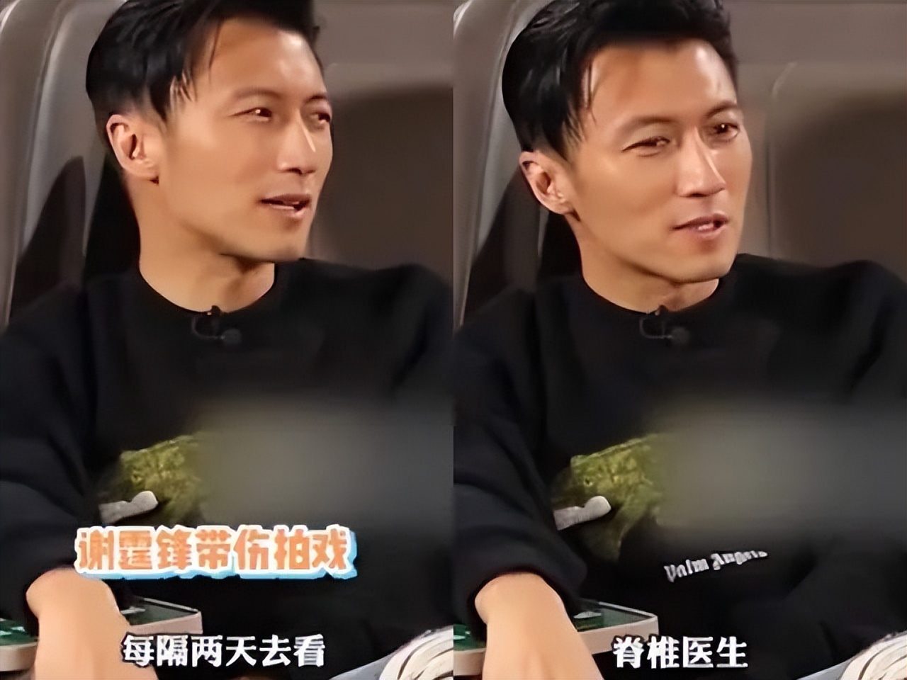 这7位明星，都因拍戏受重伤，留下“后遗症”，一个比一个严重