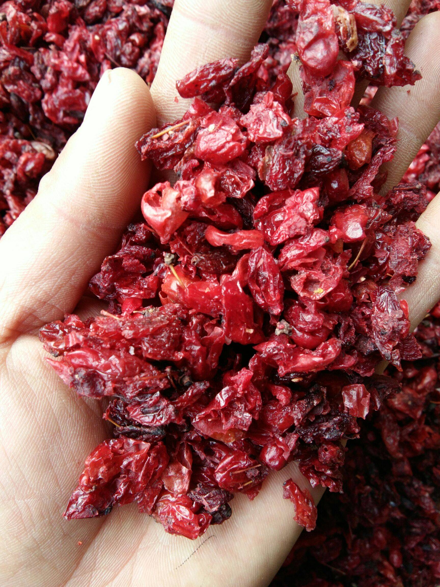 慢性前列腺炎三五年,尿频,功能下降,中医一方补肾化瘀祛湿