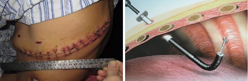 重疾险治疗方式与合同约定不一样，保险公司要赔吗？