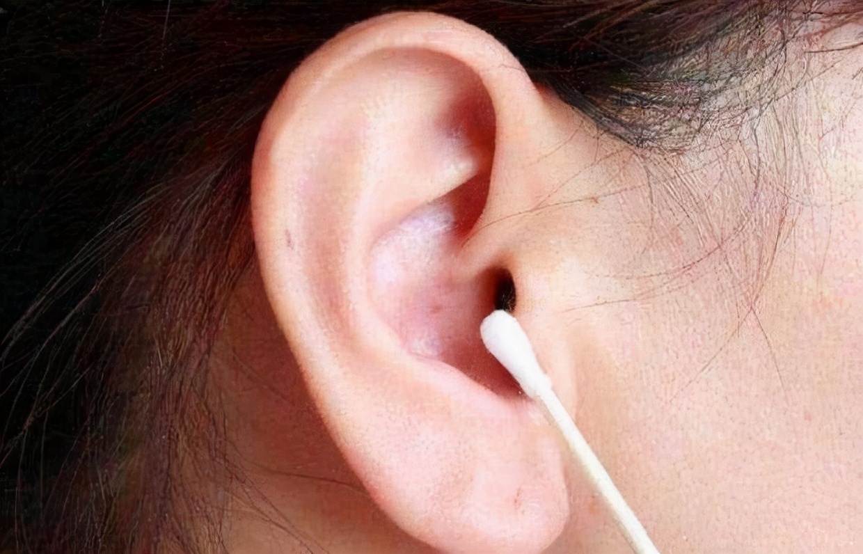为什么有的人“耳屎”是湿的，有的是干的？或许与这件尴尬事有关