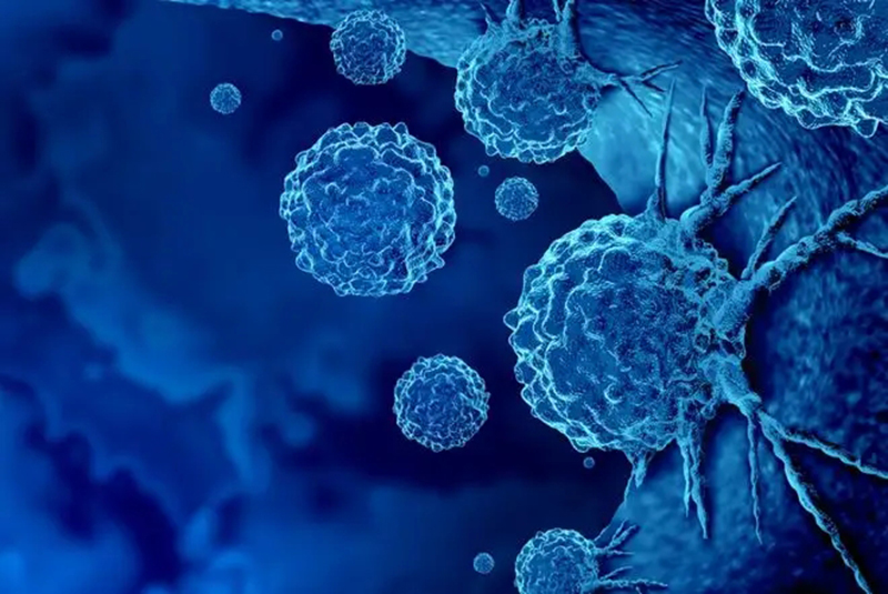 在进行英语OO翻译时，知行君认为这三点一定要特别注意