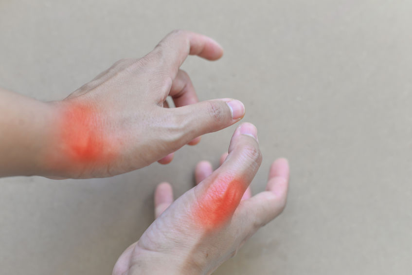 高血压患者更易得痛风？提醒：引发痛风真正的诱因有5个，需警惕