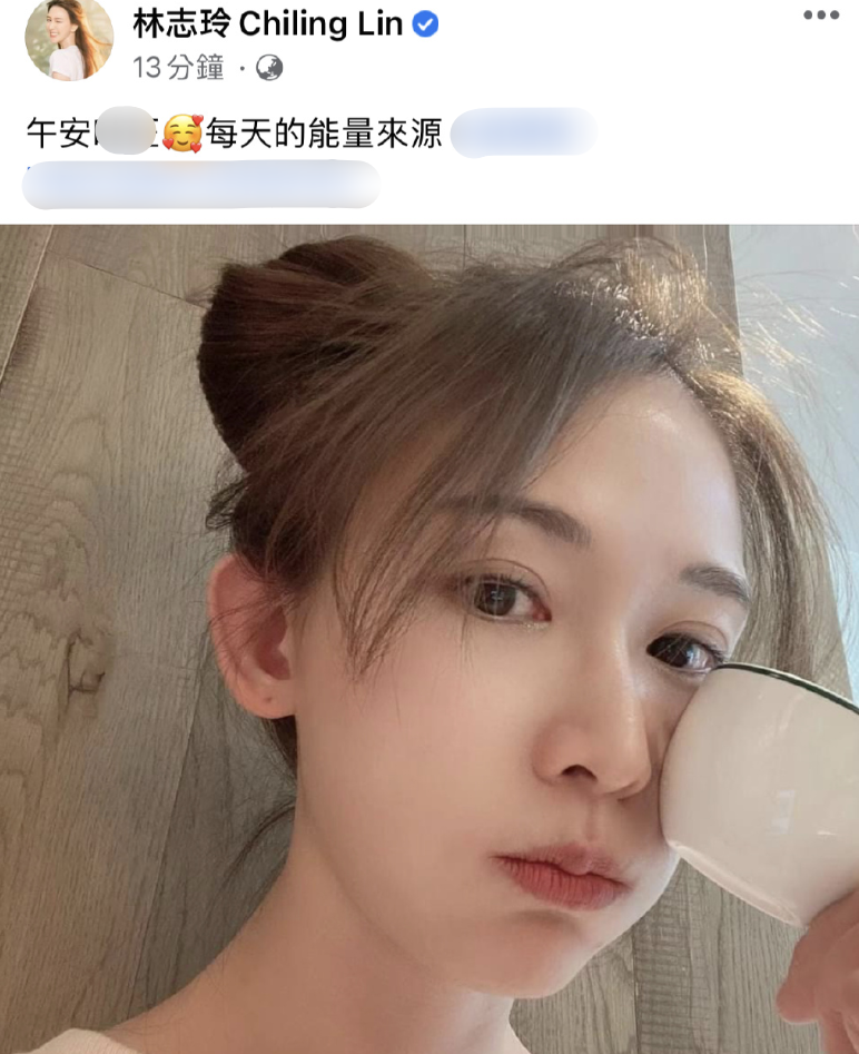 林志玲生子后首晒照，发际线飙升认不出，额头发量稀疏脑门锃亮